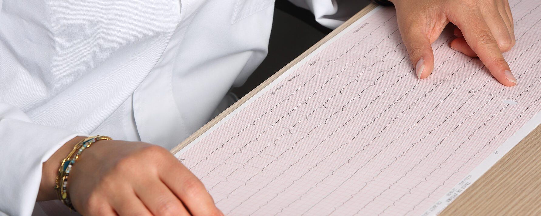 Bases de la lecture et de l’interprétation des ECG